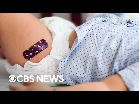 CDC panel changes measles, mumps, rubella, varicella vaccine recommendation