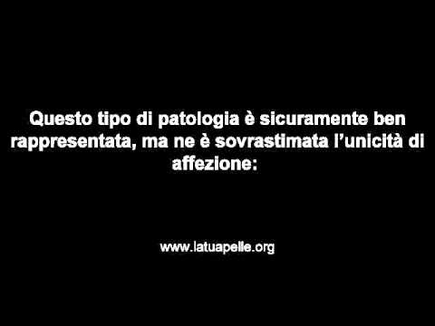 Tramando come restituire la potenza Chirurgia di allungamento del pene