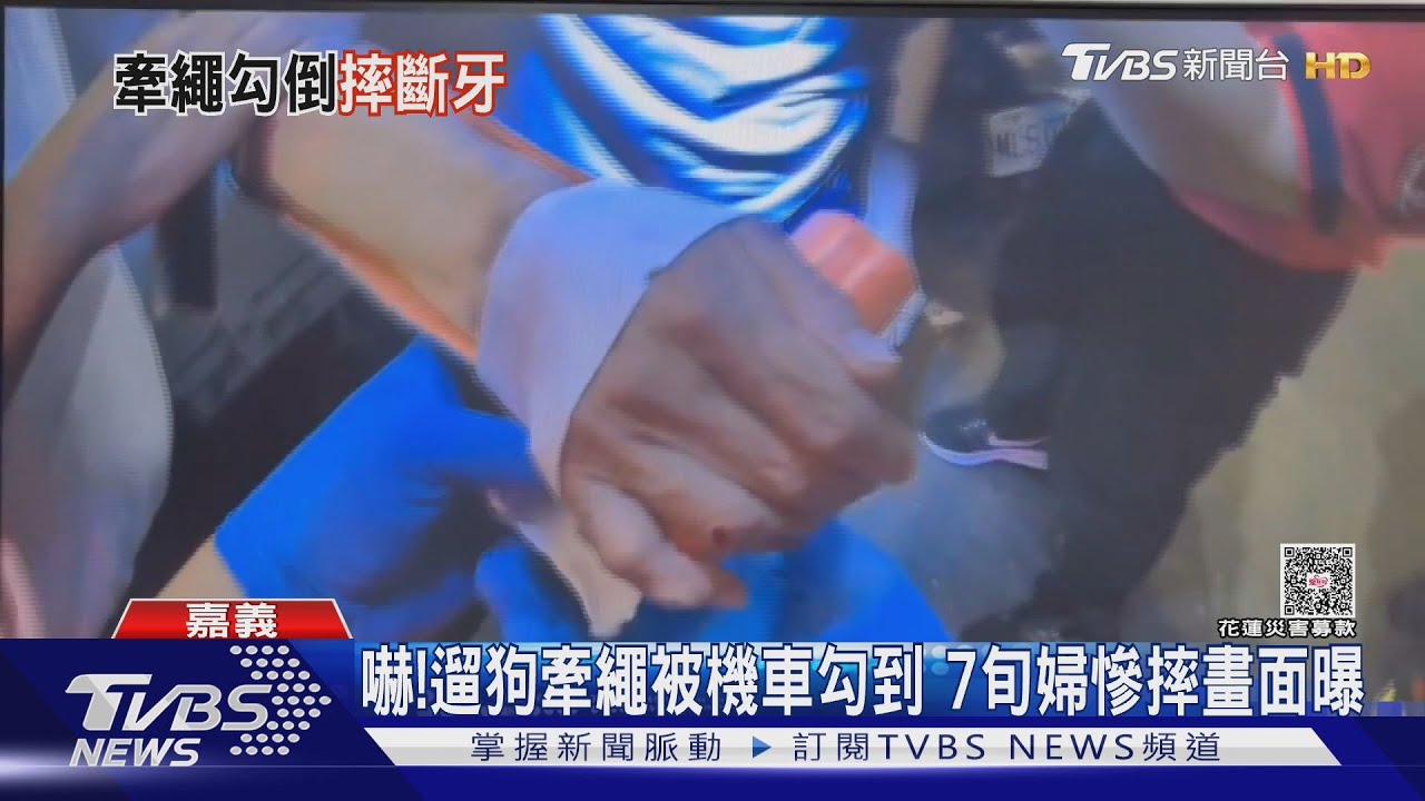 太慘了! 遛狗牽繩太長 女慘被機車勾倒手斷.牙斷