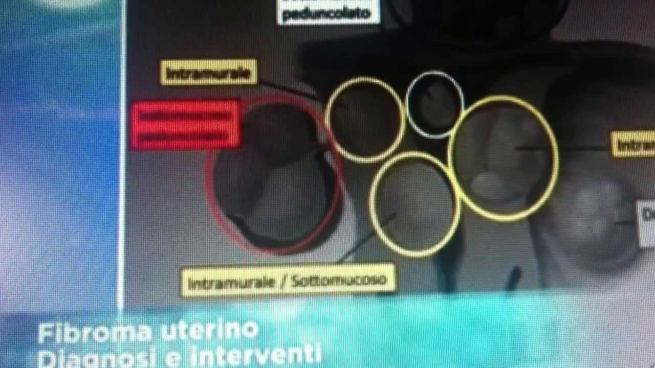 Tommaso Lupattelli-22