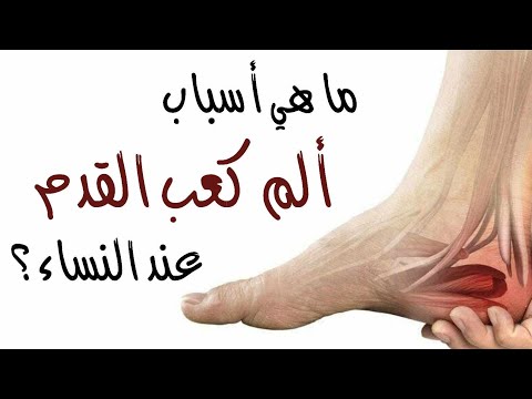 ما هي أسباب ألم كعب القدم عند النساء ؟