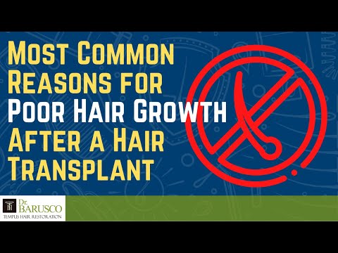 Poor Hair Growth After a Hair Transplant? Here are the Most Common Reasons For It..