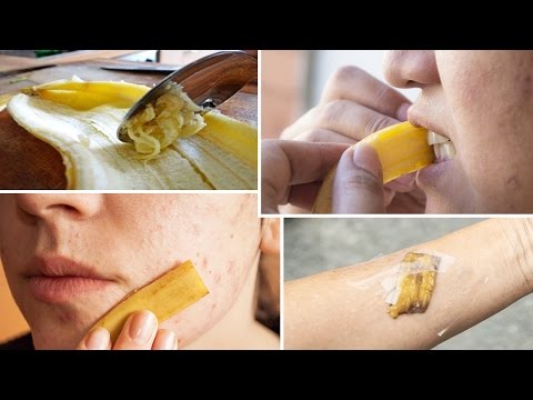 Die Invalidität die Schuppenflechte zu bekommen Welche Vitamine man bei atopitscheskom die Hautentzündung trinken kann