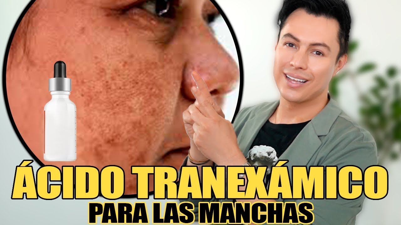 Ácido Tranexámico Lo Que Necesitas Para Manchas, Melasma En La Cara