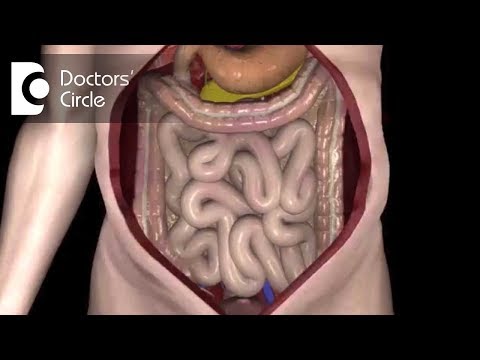 Various techniques of Hyperthermic Intraperitoneal Chemotherapy delivery - Dr. Somashekhar S P