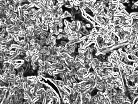 download lagu mp3 mp4 Frank Zappa Imaginary Diseases, download mp3 Frank Zappa Imaginary Diseases free download mp3, download mp3 Frank Zappa Imaginary Diseases