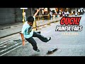 Broken Bones PAINFUL FAILS Fails Compilation