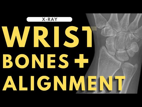 Wrist bones and alignment | Radiology anatomy part 1 prep | Wrist X-ray interpretation