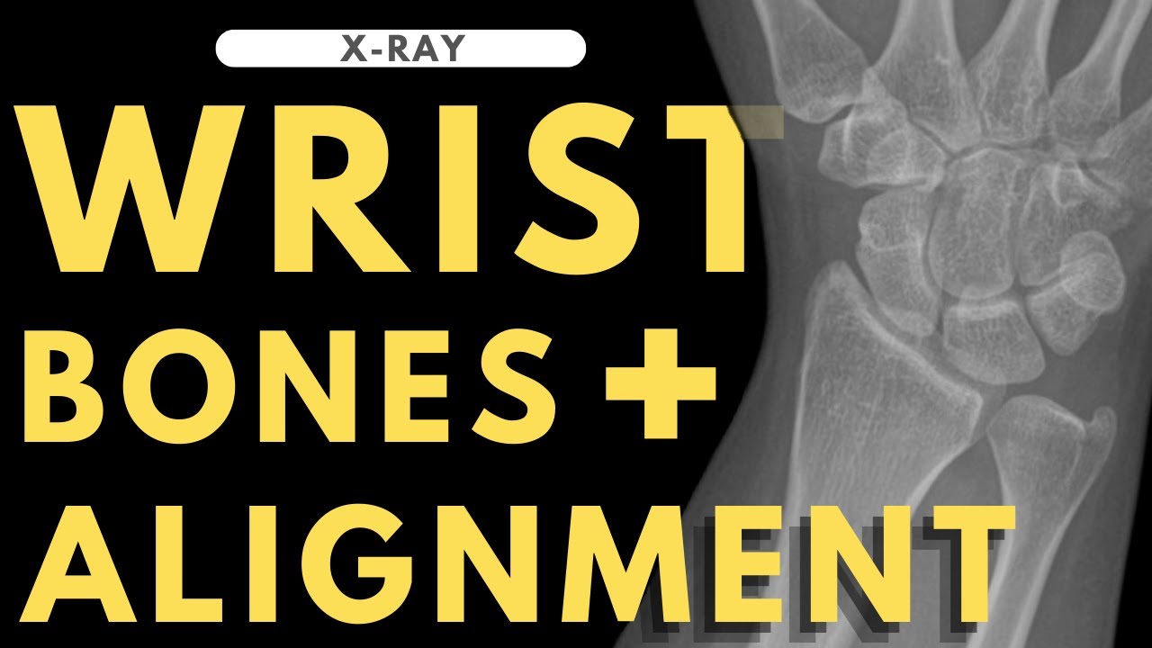 Wrist bones and alignment | Radiology anatomy part 1 prep | Wrist X-ray interpretation