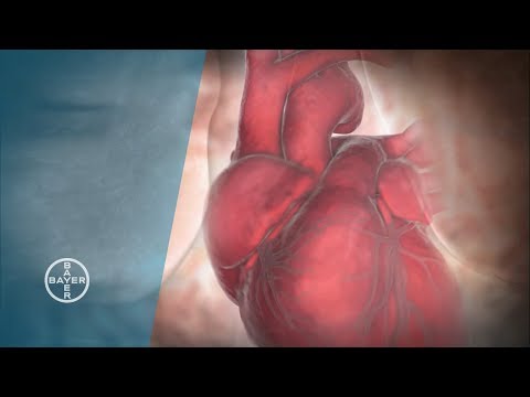 Zur Diagnose von Nieren Hypertonie Allergien gegen Medikamente gegen Bluthochdruck