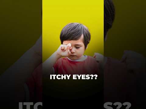 Top 5 Remedies for Itchy Eyes | Eye Allergy Relief Tips #eyecare #shorts