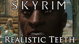 Skyrim Mod Spotlight: Realistic Teeth