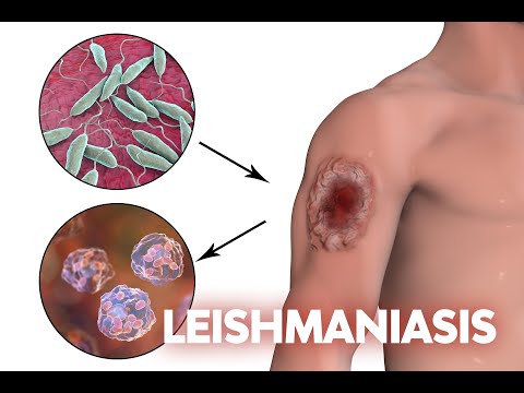 Las leishmaniasis son enfermedades endémicas que afectan al noroeste argentino