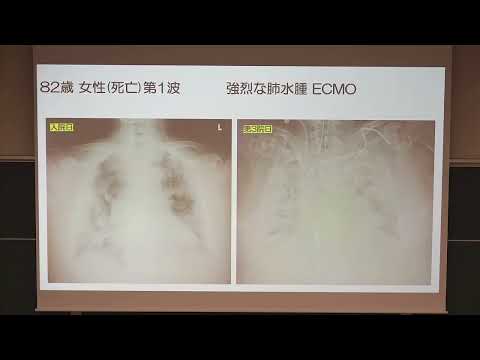 看護学科 【兵庫医科大学】模擬授業「救命医の僕はこんなことを考えている」(医学部OPEN CAMPUS 2021)