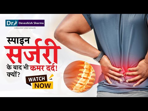 Rückenschmerzen, Steifheit und Taubheitsgefühle auch nach einer Wirbelsäulenoperation? Erfahren S...