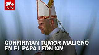 El Papa León XIV tiene cáncer de pulmón: el Vaticano confirmó así el diagnóstico