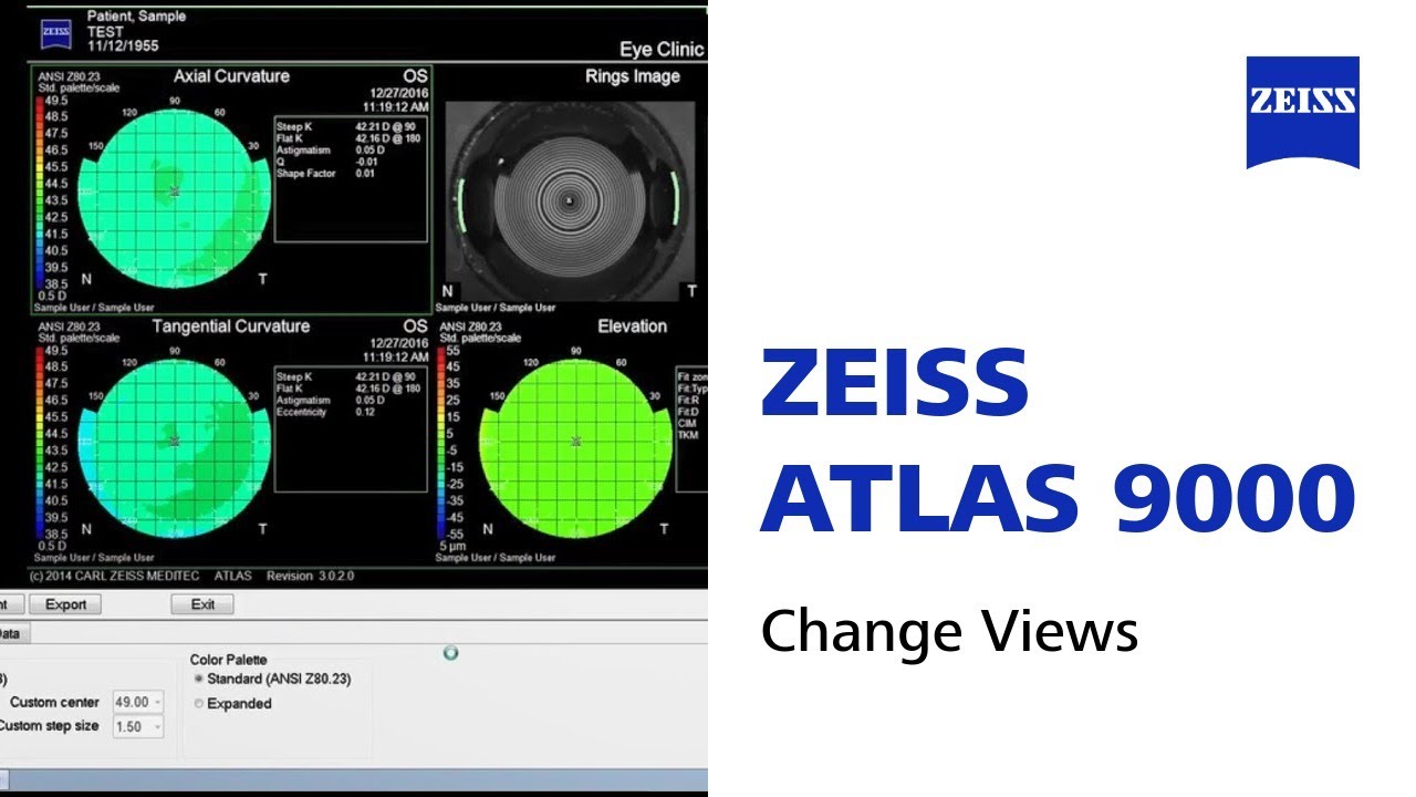 How to change views on the ATLAS 9000