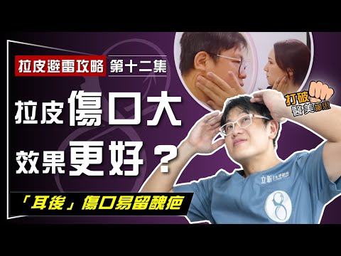 【拉皮避雷攻略｜第十二集】拉皮手術傷口大效果更好嗎？ 老派舊時「剪皮」手術該OUT了！ 醫學論文：「耳後」傷口易留醜疤