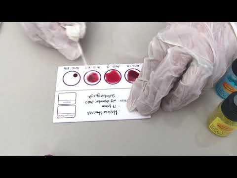 { IMUNOHEMATOLOGI} Pemeriksaan Penentuan Golongan Darah Oleh Ajeng Rifnida Husmi.