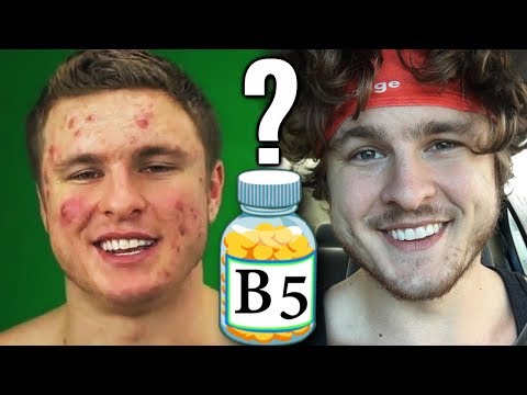 Vitamin B5: The Secret To Clearing Acne?