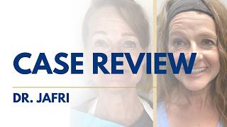 Case Review: Broken Partials to Fixed Teeth with All-On-X Implants