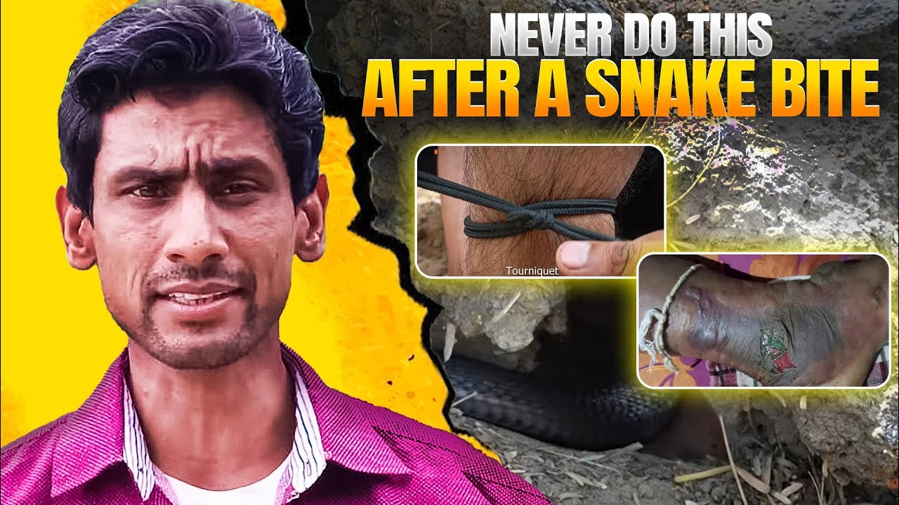 Snake bite first aid guide Pakistan