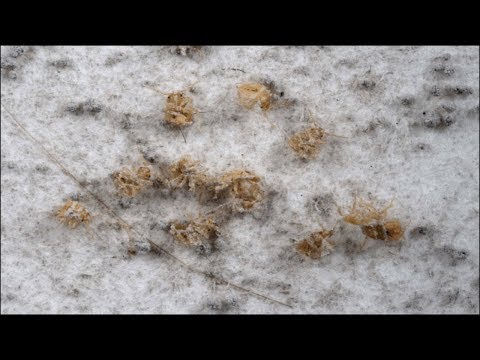 How To Get Rid of Bed Bugs for Good (CHEAP WAY)