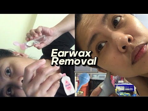 How to Safely Remove Earwax at Home Using Baby Oil and Bulb Syringe| Health
