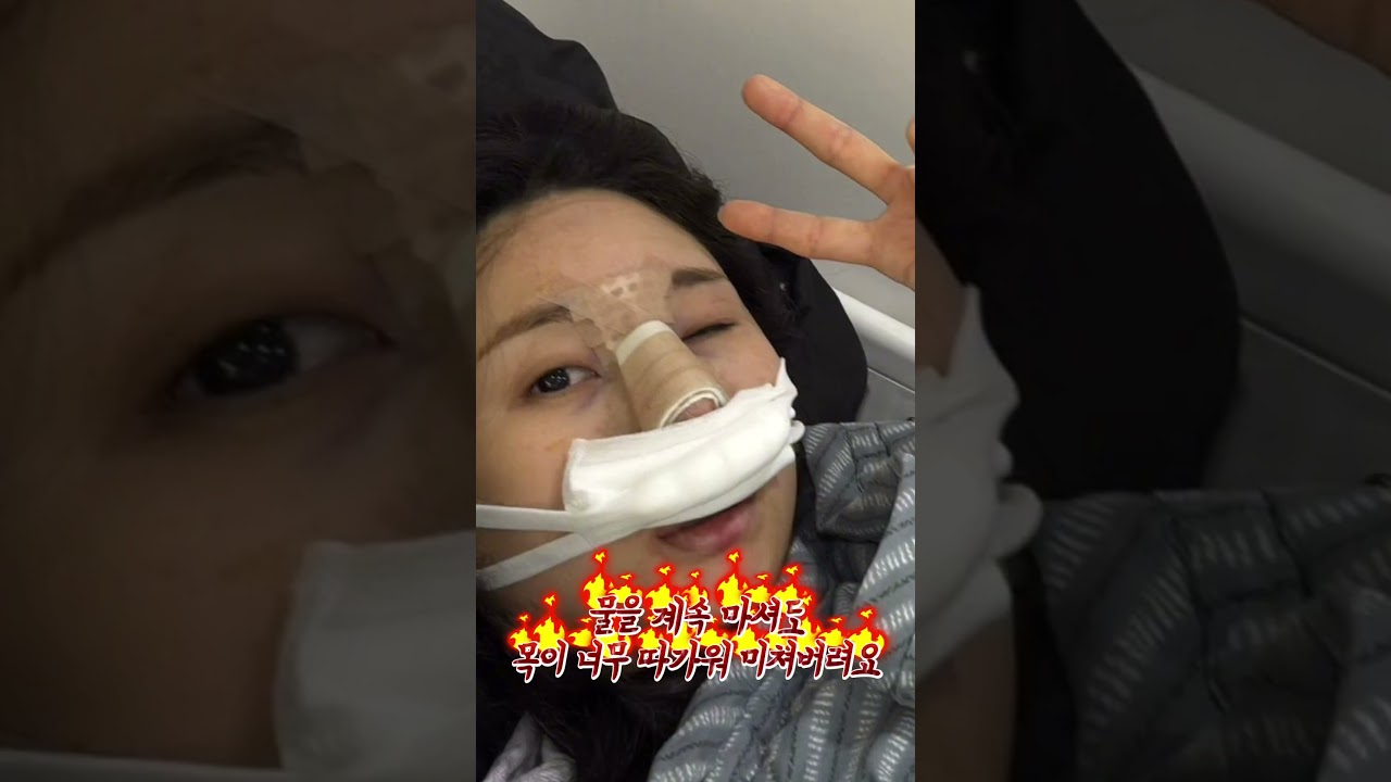 콤플렉스였던 매부리코👃🏻,%%이제는 자연스럽고 세련된 옆 라인으로✨!