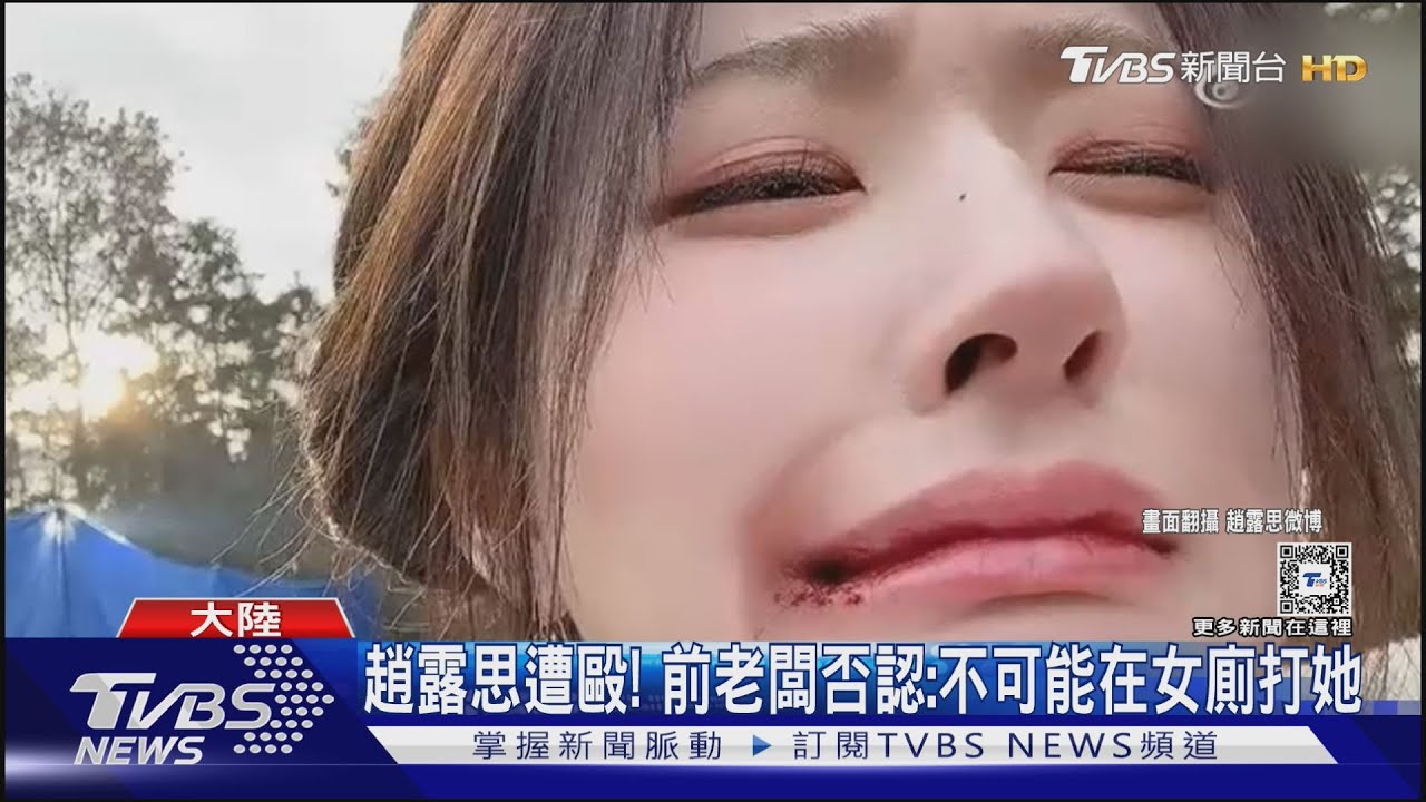 趙露思認了遭毆打！　點名「她」拿走鉅額分手費、網當柯南抓兇