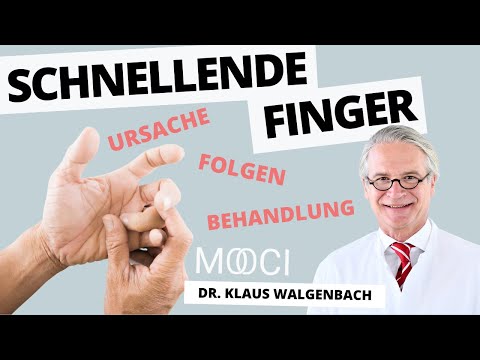 Schnellender Finger - Ursachen und Behandlung für Schnappfinger!