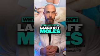 Download lagu Should you laser your moles? Derm explains why this is a BAD idea! #laser #moles mp3 Download lagu Should you laser your moles? Derm explains why this is a BAD idea! #laser #moles mp3