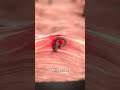 What Is An Ingrown Hair? 😟