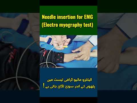 EMG Needle Insertion: A Patient's Guide | What to Expect