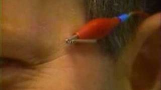 Discover Electric Man