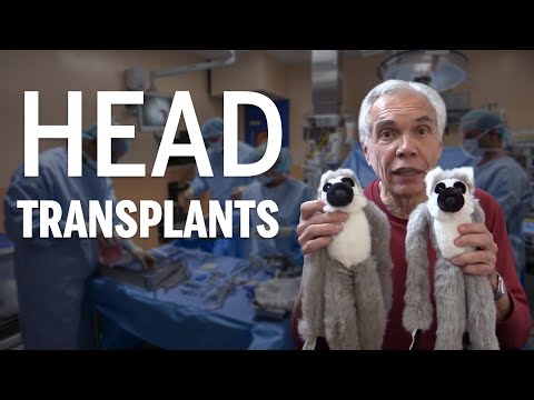 Dr. Joe Schwarcz discusses head transplants