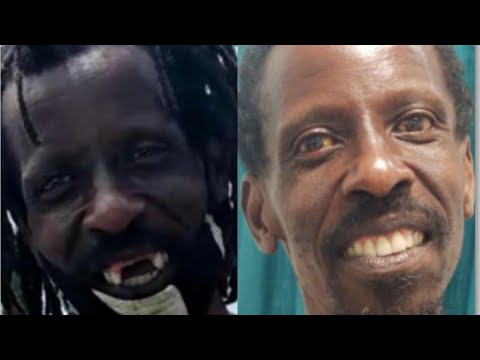 Wet man Kenrick fix his teeth 🦷 @dental_impact WetWetWet