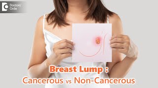 Breast Lumps:Cancerous vs Non-Cancerous |Are all lumps dangerous?-Dr.Nanda Rajneesh| Doctors