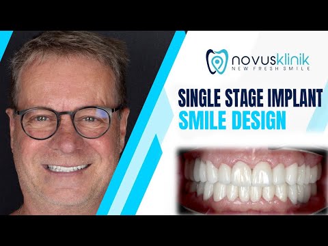 Logo of Novusklinik Patient Journey – Affordable Dental Implants in Istanbul, Turkey