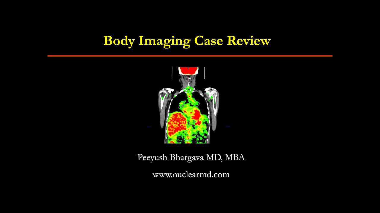 Body imaging # 27
