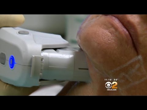 download lagu mp3 mp4 Lm Thermage u Tt, download lagu Lm Thermage u Tt gratis, unduh video klip Lm Thermage u Tt