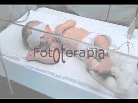 Le buone creme di decolorazione da pigmentary notano risposte Laccrescimento pigmentary posti