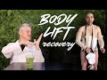 Erholung Nach Einem Bodylift Podcast Zur Hautentfernungsoperation