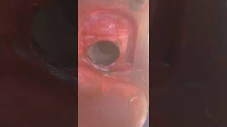 The Darkness (part 2 of 2, aka 2nd part of part 1)