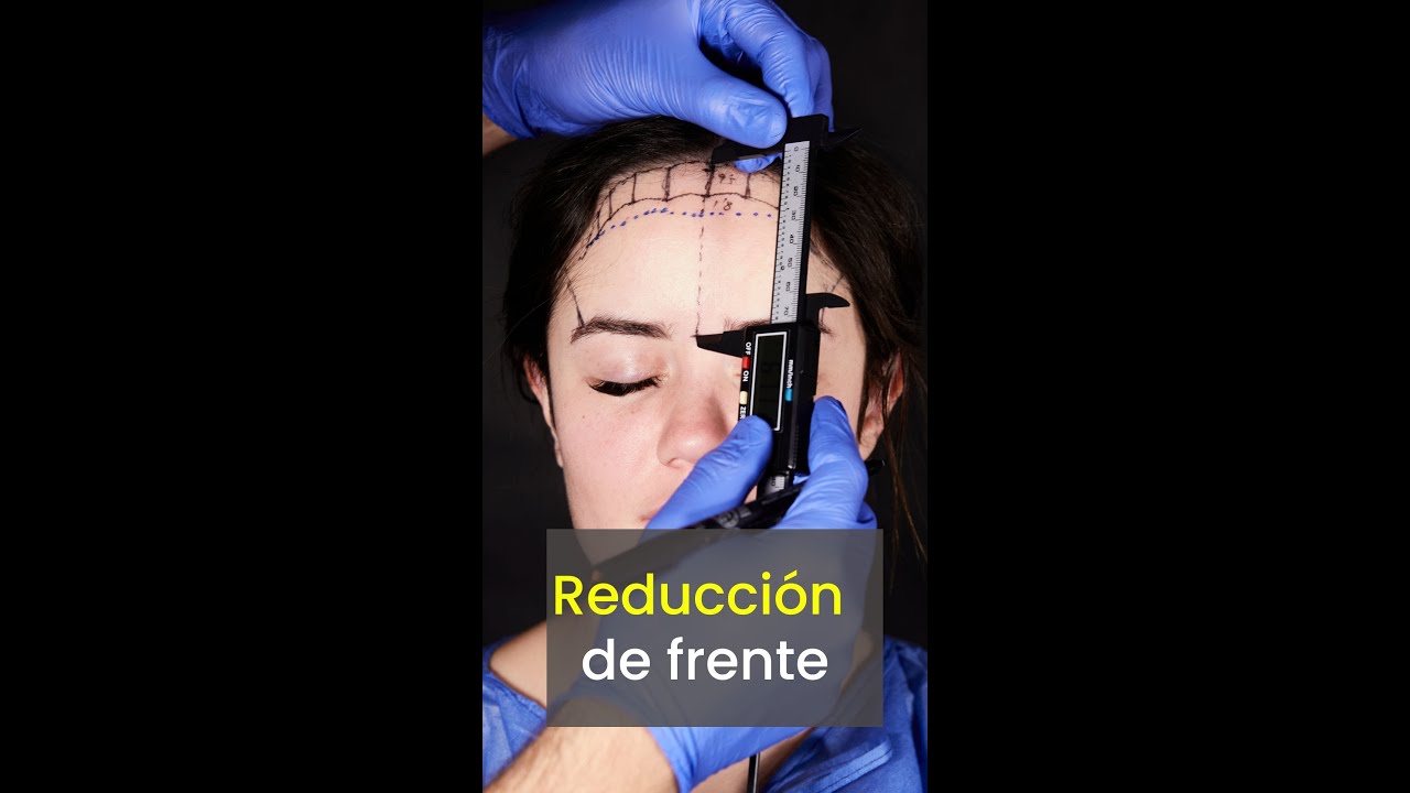 Alexo Carballeira Braña-15