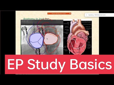 Basics of Cardiac #electrophysiologic study part 1 #epstudy #ablation #SVT #EPS #drnarendrakumar