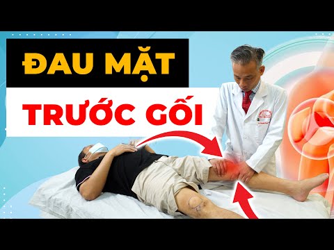 Hội chứng Bánh chè xương đùi - Điều trị thế nào?