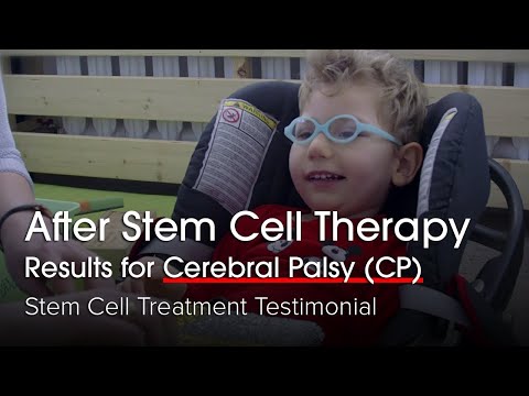 Alexander's Journey to New Beginnings: Stem Cell Therapy for Cerebral Palsy in Bangkok Thailand