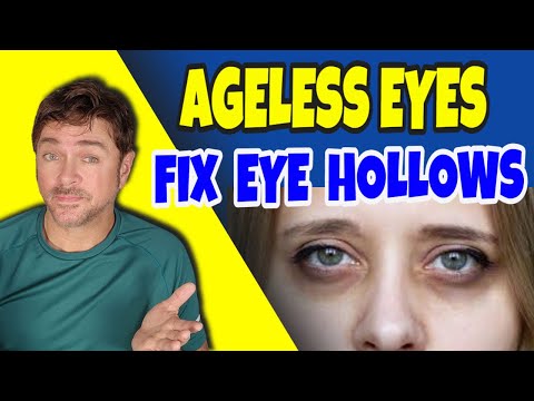 Help For Under Eye Hollows & Sunken Eyes | Chris Gibson