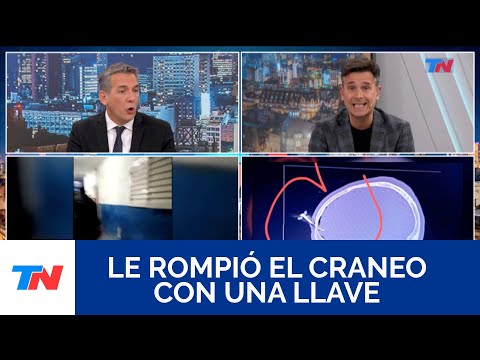 Berazategui: Le clavaron una llave de auto en medio de la frente